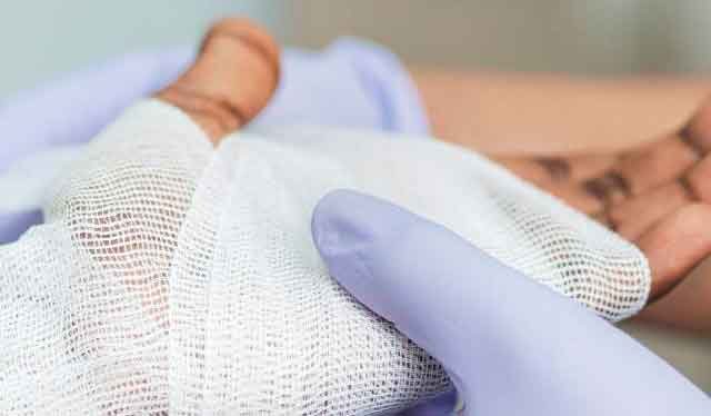 Wound Care Services