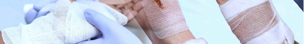 Wound Care Types