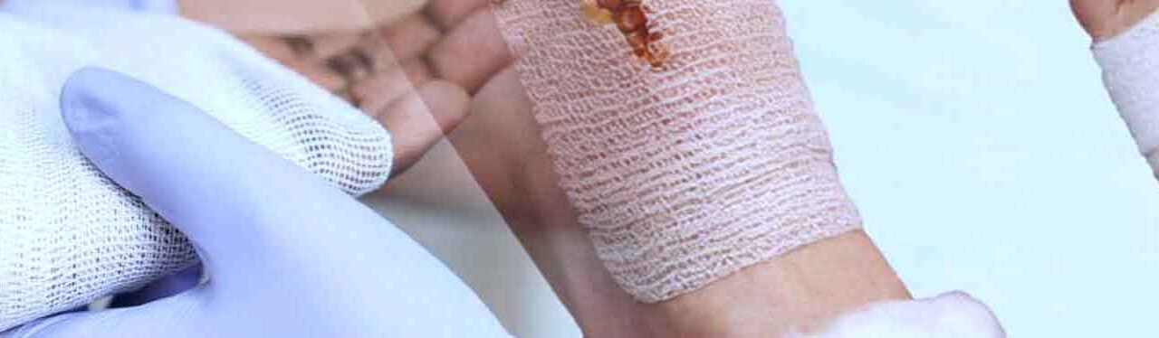 Wound Care Types
